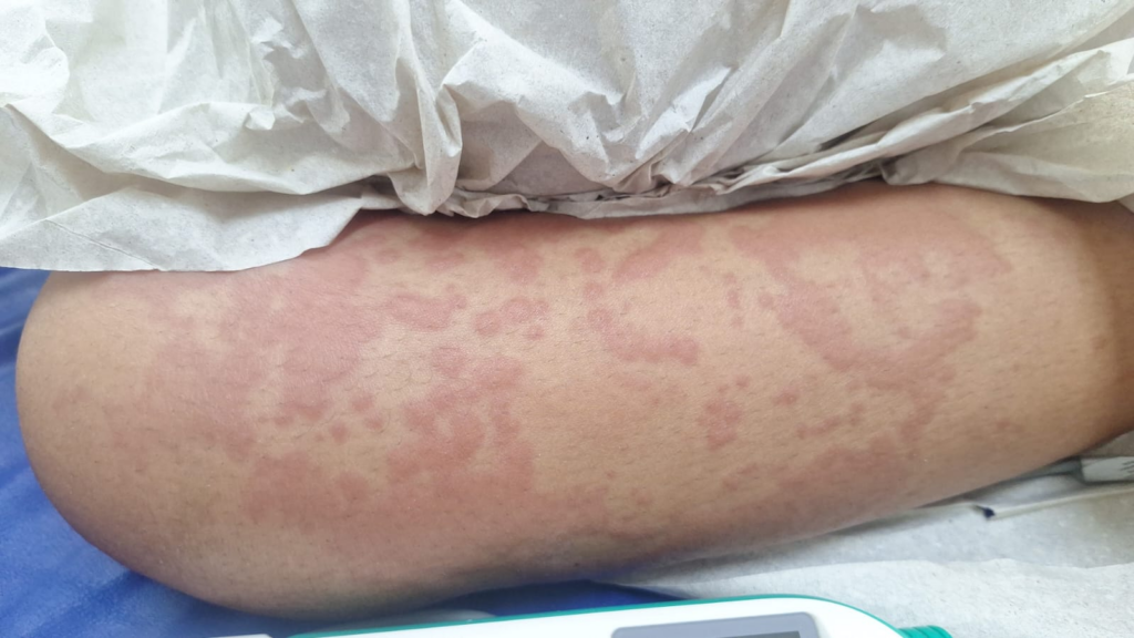 Dr. Kleber Luz analisa o caso