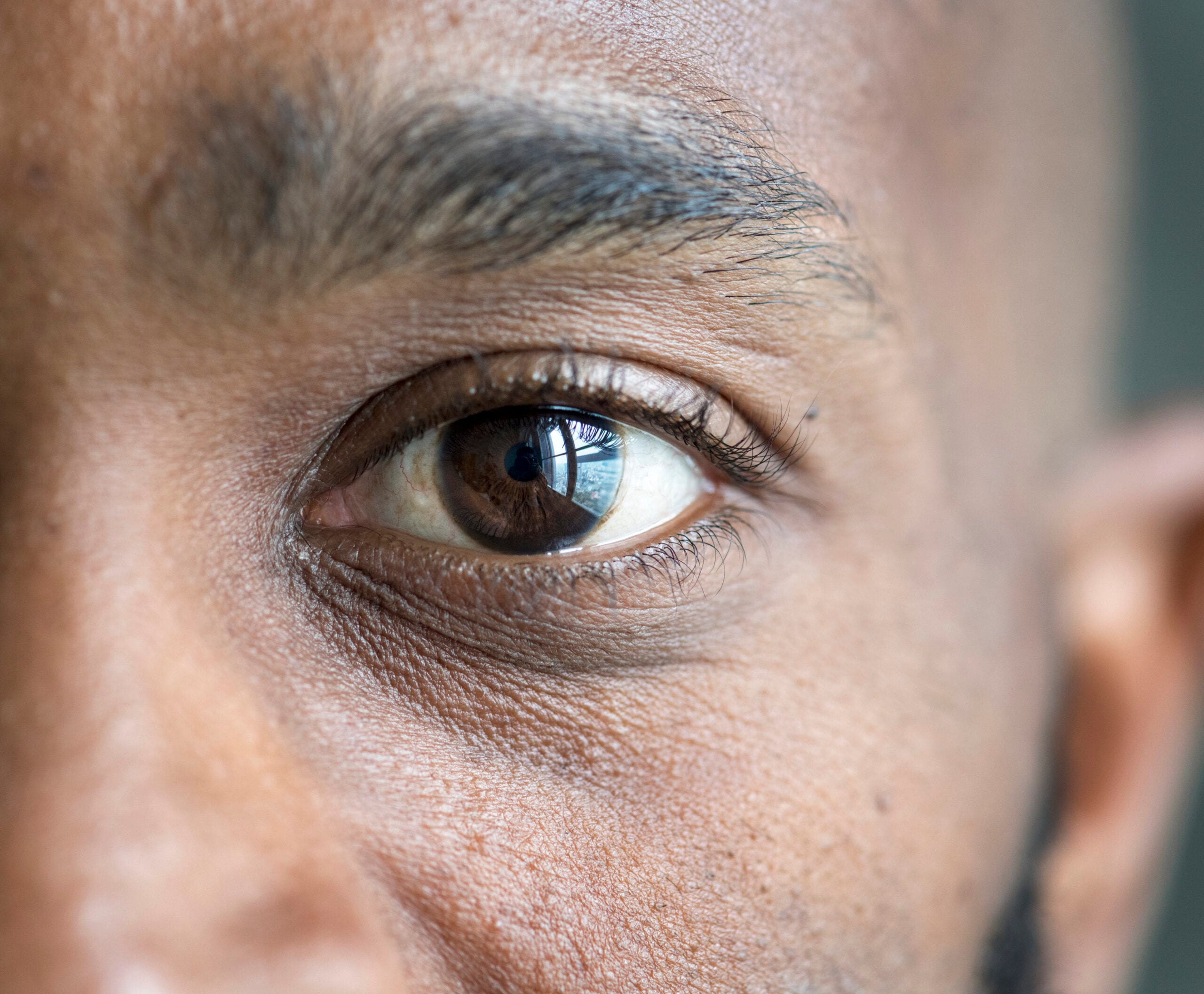 olhos iris